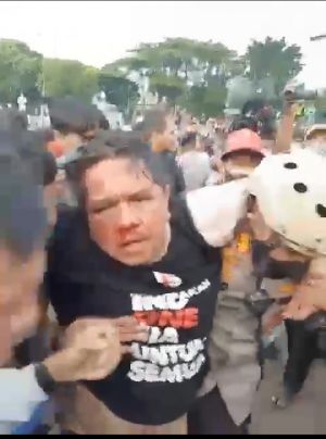 Ade Armando Dianiaya Massa Demo, Polisi Lakukan Penyelidikan