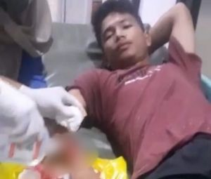 Beni Kena Bacok Geng Motor Saat Melintasi Kawasan Kebun Jeruk