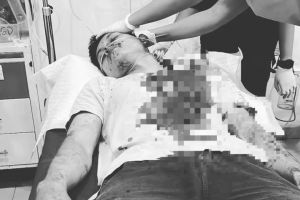 Anggota Polda Jambi Kena Bacok Saat Lerai Keributan Antar Geng di Arizona